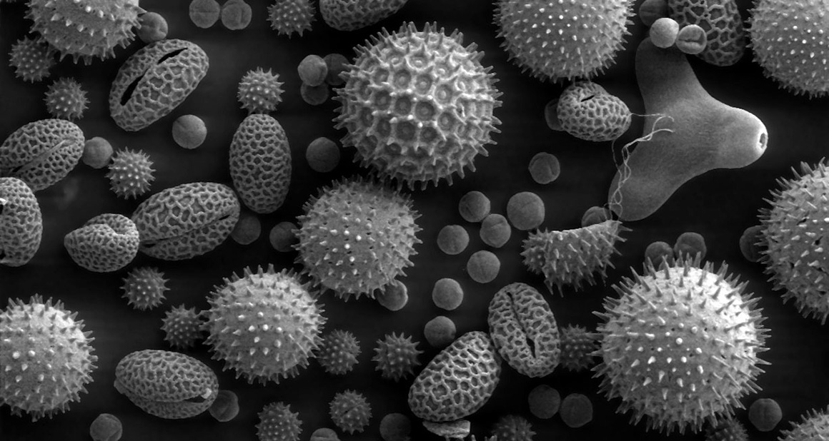Pollen; Image Wikipedia/UCAR